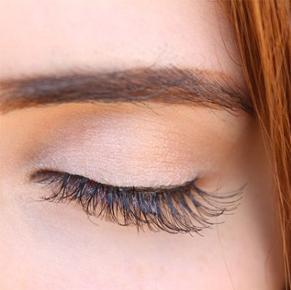 dermal filler for brow lift