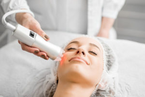 woman receiving laser for pigmentation