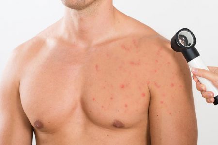 men's treatments - dermatology