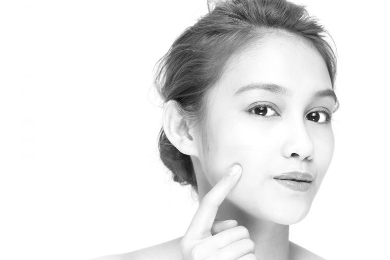 acne scar treatment