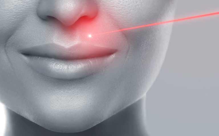 laser skin rejuvenation