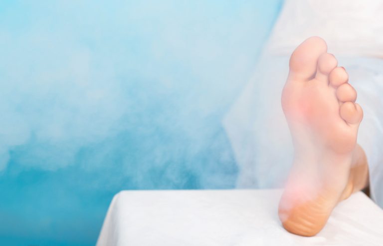 liquid nitrogen to remove spots