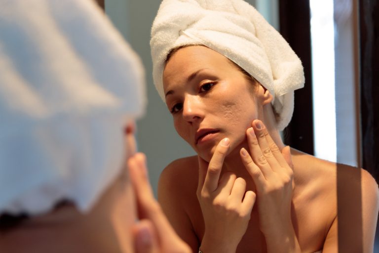 different scars treatments