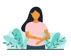 woman with psoriasis on arms drawing