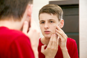 young man inspecting facial acne in a mirror